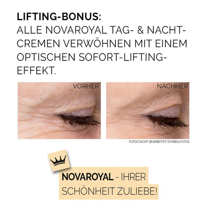 Phyto Deluxe Anti-Aging Creme – Straffende Tages- & Nachtpflege Mit Prämierten Hightech-Wirkstoffen – Sichtbar Wirksam Selbst Bei Ausgeprägten Falten – 50 Ml – NOVAROYAL