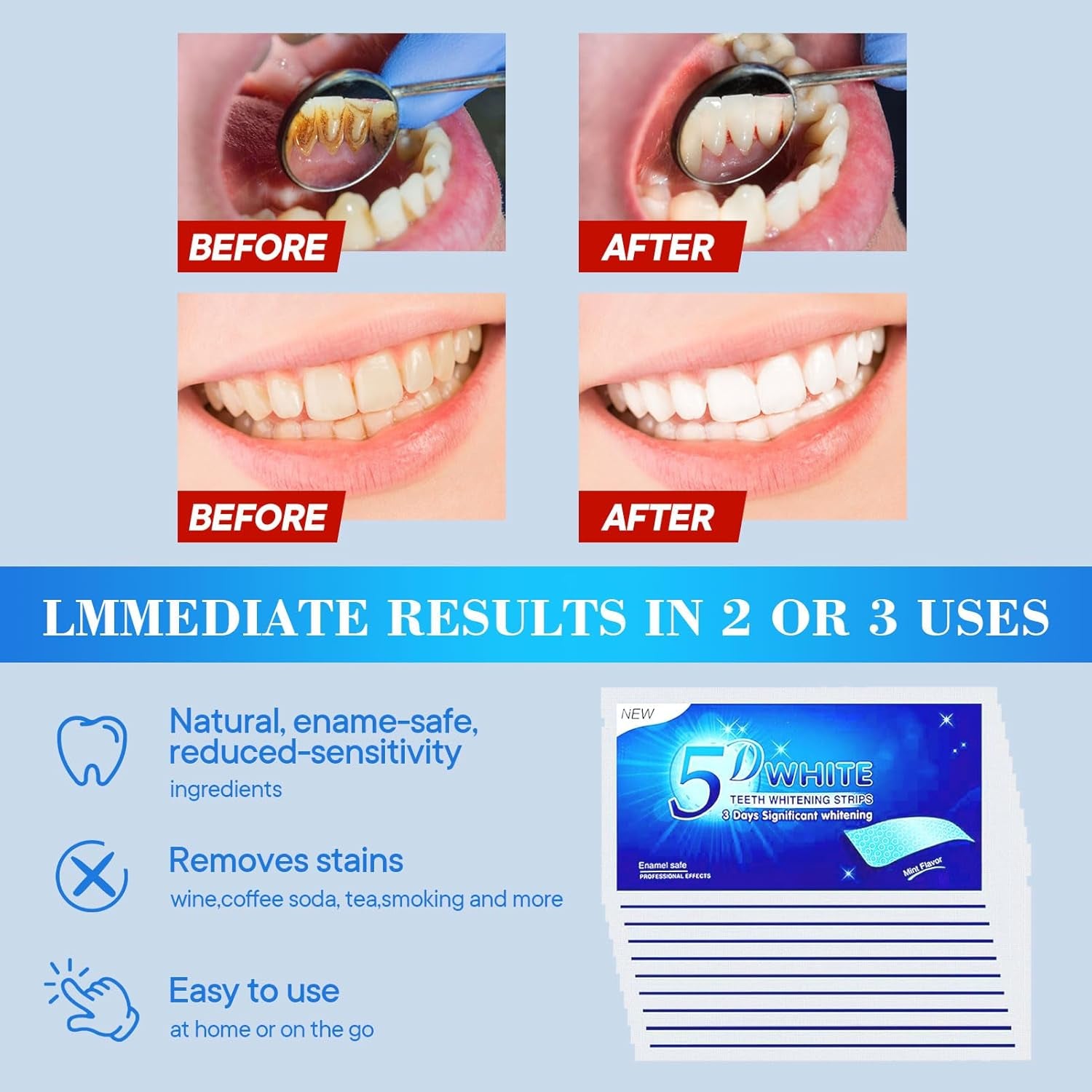 Teeth Whitening Strips - 28 Zahnaufhellung Peroxid Frei Non-Sensitive Formel Mit Minzgeschmack - Sicher Für Zahnschmelz